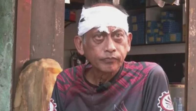 অভিনেতা সমু চৌধুরীর মাথা ফাটালেন গ্যারেজ মালিক ও মেকানিক