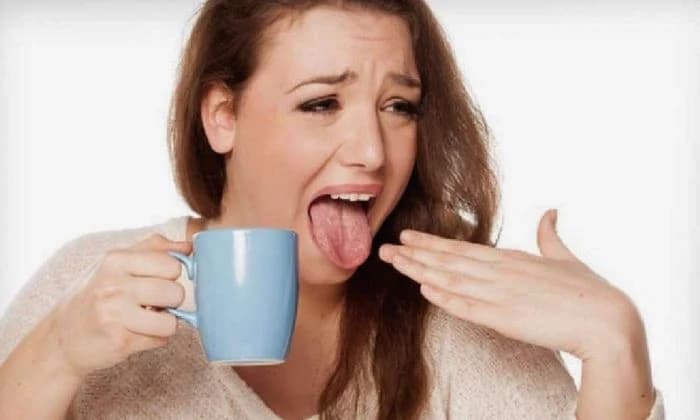 গরম খাবার খাওয়ার সময় জিভ পুড়ে গেলে করণীয় কি