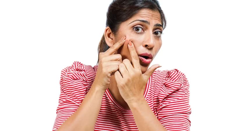 শীতে ব্রণ কেন বাড়ে? মুক্তি পাবেন যে উপায়ে